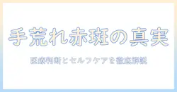手荒れ 赤い 斑点の原因と対処法—医療の判断基準とセルフケア