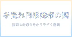 手荒れと円形の発疹の原因と対策｜手荒れと円形の症状を見分けるポイントと対処法
