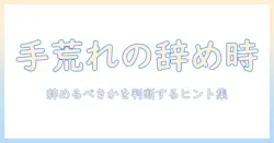 手荒れに悩むバイト経験者が辞めるべきか判断するための対策と情報