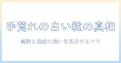 手荒れと白いプツプツの正体とは?原因・セルフケア・医療判断のポイント