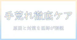手荒れ・かゆみ・治らないときの原因と対策｜医師が教える手荒れケアのポイント