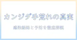 カンジダは手荒れにうつるのか?手荒れの原因がカンジダかを理解するための徹底ガイド