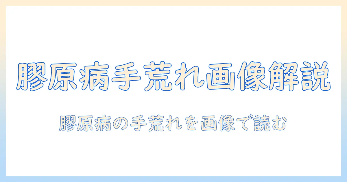 膠原病と手荒れの画像で見る病態と治療 — 膠原・病・手荒れ・画像を詳しく解説