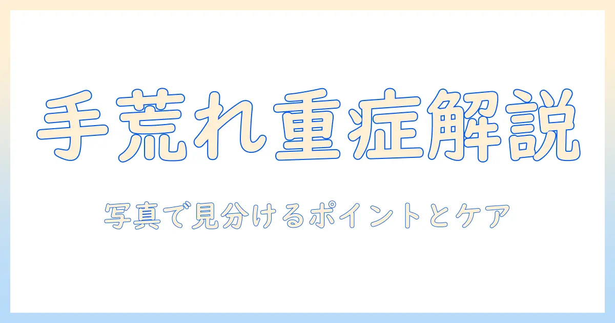 手荒れの重症を画像で解説!症状の見分け方と自宅ケアのポイント
